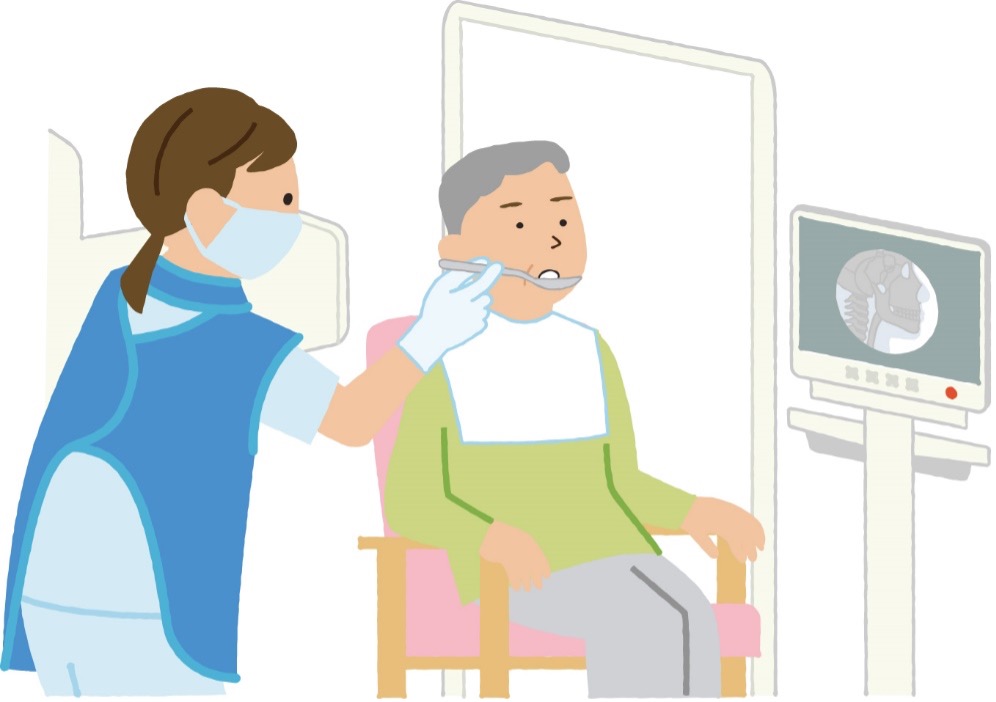嚥下内視鏡検査のイメージ
